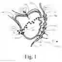 Fig. 02 - Topical Eutectic Anesthetic Composition for Oral or Dermal Tissue