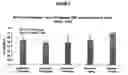 Fig. 02 - NOVEL TRICYCLIC COMPOUNDS USEFUL FOR THE TREATMENT OF INFLAMMATORY AND ALLERGIC DISORDERS: PROCESS FOR THEIR PREPARATION AND PHARMACEUTICAL COMPOSITIONS CONTAINING THEM