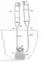 Fig. 01 - Devices for minimally invasive pelvic surgery