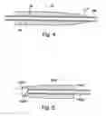 Fig. 05 - Devices for minimally invasive pelvic surgery
