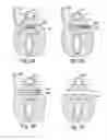 Fig. 28 - Devices for minimally invasive pelvic surgery