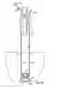Fig. 46 - Devices for minimally invasive pelvic surgery