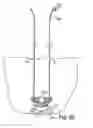 Fig. 49 - Devices for minimally invasive pelvic surgery