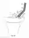 Fig. 53 - Devices for minimally invasive pelvic surgery