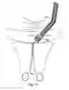 Fig. 56 - Devices for minimally invasive pelvic surgery