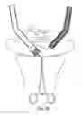 Fig. 58 - Devices for minimally invasive pelvic surgery