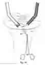 Fig. 60 - Devices for minimally invasive pelvic surgery
