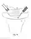 Fig. 63 - Devices for minimally invasive pelvic surgery