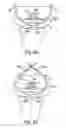 Fig. 64 - Devices for minimally invasive pelvic surgery