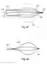 Fig. 67 - Devices for minimally invasive pelvic surgery
