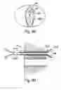 Fig. 68 - Devices for minimally invasive pelvic surgery
