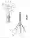 Fig. 07 - MECHANICAL DISTENSION SYSTEMS FOR PERFORMING A MEDICAL PROCEDURE IN A REMOTE SPACE