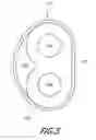 Fig. 14 - MECHANICAL DISTENSION SYSTEMS FOR PERFORMING A MEDICAL PROCEDURE IN A REMOTE SPACE