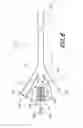 Fig. 15 - MECHANICAL DISTENSION SYSTEMS FOR PERFORMING A MEDICAL PROCEDURE IN A REMOTE SPACE