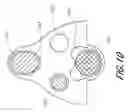 Fig. 19 - Methods for performing a medical procedure