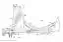 Fig. 01 - INTUBATION INSTRUMENT