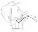 Fig. 01 - Dilating Laryngoscope