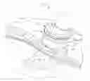 Fig. 01 - Fully automated iris seal for hand assisted laparoscopic surgical procedures