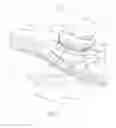 Fig. 02 - Fully automated iris seal for hand assisted laparoscopic surgical procedures