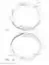 Fig. 09 - Fully automated iris seal for hand assisted laparoscopic surgical procedures
