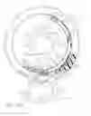 Fig. 20 - Fully automated iris seal for hand assisted laparoscopic surgical procedures