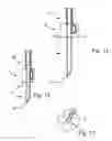 Fig. 07 - Microsensor needle for pH measurement in tissue