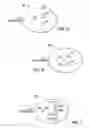 Fig. 04 - System and method for detection of skin wounds and compartment syndromes