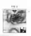 Fig. 06 - METHOD AND APPARATUS FOR MEDICAL INTERVENTION PROCEDURE PLANNING