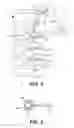 Fig. 02 - Medical device for determining the position of intracorporeal implants