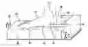 Fig. 01 - Ultrasonic bone assessment apparatus and method