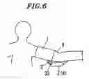 Fig. 07 - Sphygmomanometer