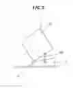 Fig. 03 - Sphygmomanometer
