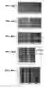 Fig. 09 - Electrocardiogram signal-processing method and electrocardiogram signal-processing device