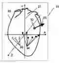 Fig. 01 - Device and system for visual three-dimensional presentation of ECG data