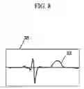 Fig. 09 - Device and system for visual three-dimensional presentation of ECG data