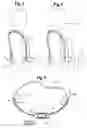 Fig. 03 - Deep breathing training device