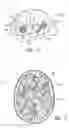 Fig. 03 - Methods for treating and/or collecting information regarding neurological disorders, including language disorders