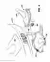 Fig. 06 - Biopsy system with vacuum control module