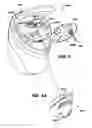 Fig. 07 - Biopsy system with vacuum control module