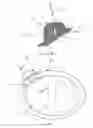 Fig. 03 - Biopsy needle guide
