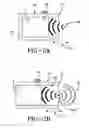 Fig. 04 - Pressure pulse/shock wave apparatus for generating waves having plane, nearly plane, convergent off target or divergent characteristics
