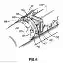 Fig. 06 - Serum Dispensing and Massage Device