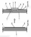 Fig. 03 - Shape and pressure adjustable dressing