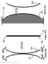 Fig. 04 - Shape and pressure adjustable dressing