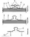Fig. 05 - Shape and pressure adjustable dressing