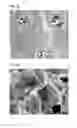 Fig. 04 - Polyurethane foam dressing with improved moisturization