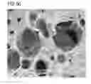 Fig. 05 - Polyurethane foam dressing with improved moisturization