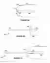 Fig. 03 - Body treatment devices and methods