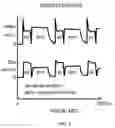 Fig. 03 - Anti-repulsion anti-clogging system and method for driving a dual-axis lensectomy probe