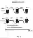 Fig. 05 - Anti-repulsion anti-clogging system and method for driving a dual-axis lensectomy probe